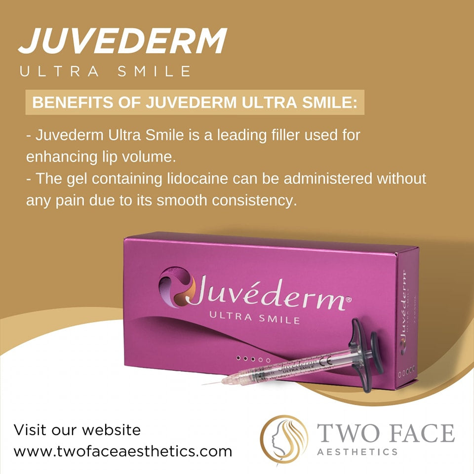 Juvederm Ultra Smile
